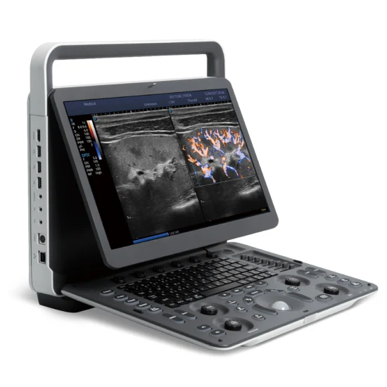 Sonoscape E3 Ultrasound Machine Portable Color Doppler Ultrasound System