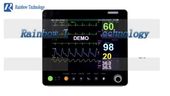 Portable Multi Parameter Veterinary Patient Monitor Pet Dog Cat Vital Sign Monitor Veterinary Diagnostic for Dog/Pig/Cat/Horses/Other Animals