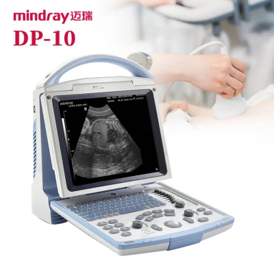 Mindray Dp10 Portable Ultrasound Machine Echograph Ultrasonic System